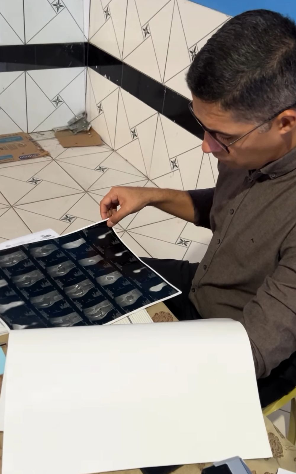 Mutirão Ortopédico realizado no Distrito Bananal